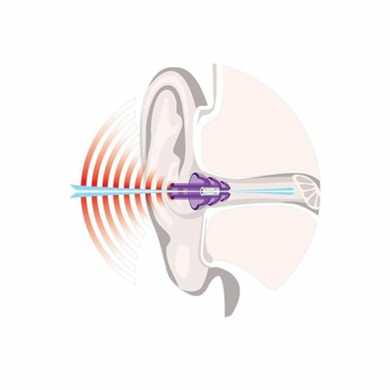 سداده اذن NoNoies Hearing Protection Music